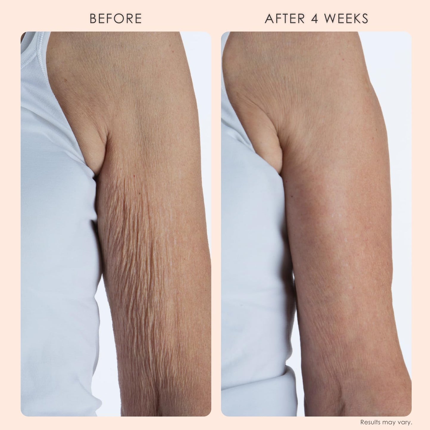 Crepe Erase Anti-Wrinkle Cream